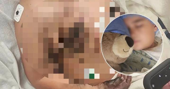 Niño de 8 años sufrió grave descarga eléctrica mientras dormía con su celular conectado