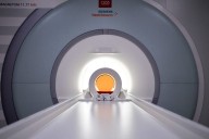 Should seniors get preventative MRIs?
