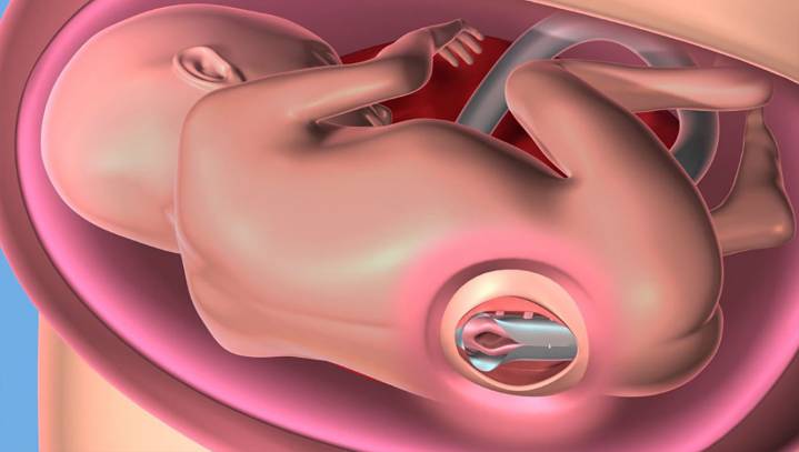 Liberals Confused By New Medical Procedure That Heals Babies Instead Of Killing Them