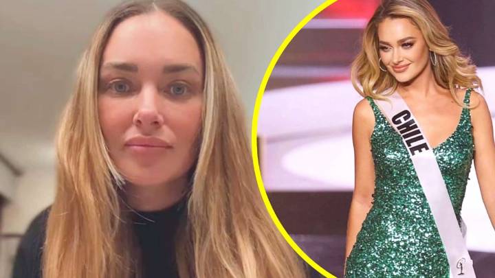 ¿Cuáles son los síntomas?: Daniela Nicolás detalla compleja enfermedad neurológica que la aqueja