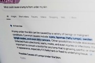 What is that rash? Doctors recommend people put some thought into asking Dr. Google for medical help