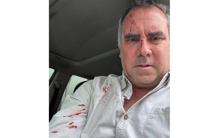 Candidato presidencial de Perú sale ileso tras ser atacado a tiros en vehículo