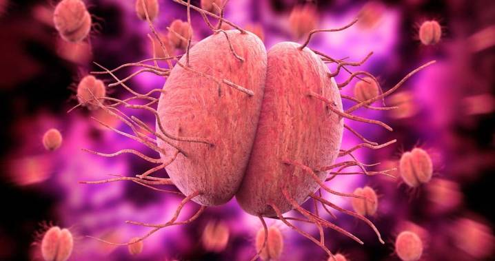 Especialistas desarrollan antibiótico eficaz de dosis única para tratar la gonorrea