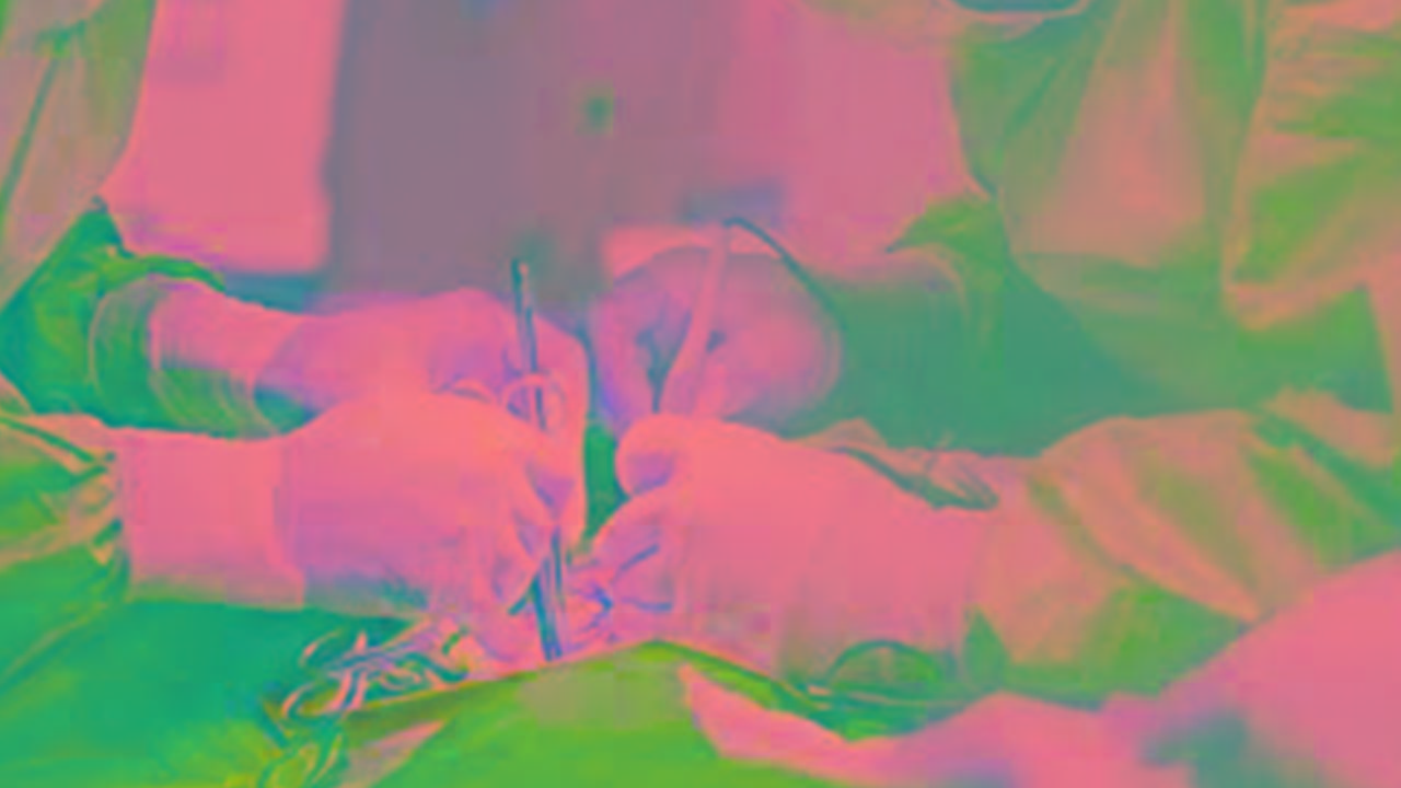 Hospital Honorio Delgado acumula 60 pacientes en espera de cirugías cardiacas, advierte Renacor