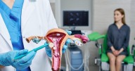 Uterine Fibroids Linked To Women's Heart Disease Risk