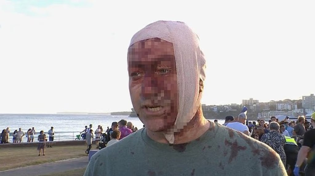 “Una masacre”: sobrevivió al ataque de Hamas del 7 de octubre y ahora lo hirieron en el tiroteo en Australia