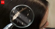 Why lice exist and where they actually came from