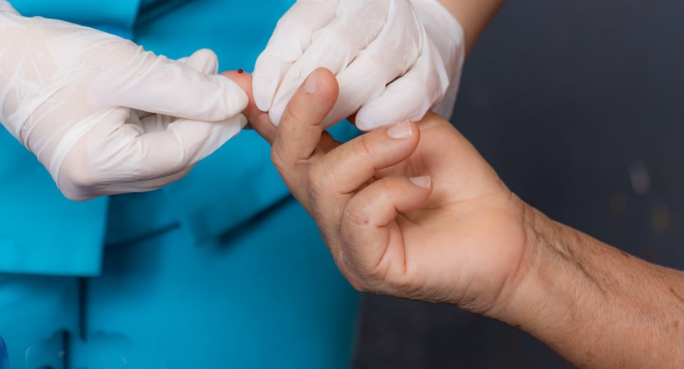 Ica registra entre 20 y 30 nuevos casos de VIH al mes y refuerzan detección con brigadas móviles