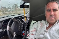 Candidato presidencial de Perú sale ileso tras ser tiroteado dentro de su vehículo