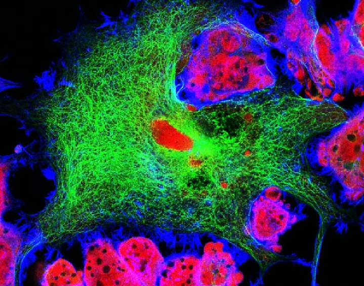 Romidepsin Identified as Candidate for Treating Relapsed Neuroblastoma