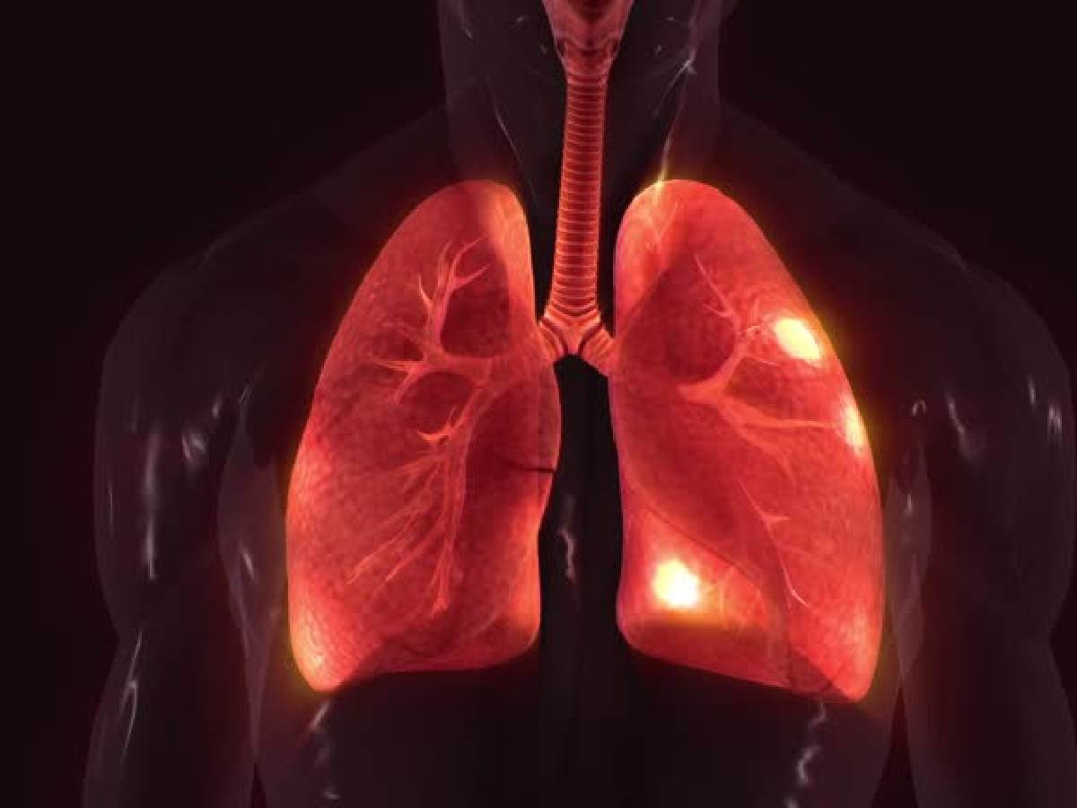 Delhi pollution drives unprecedented rise in COPD cases across hospitals