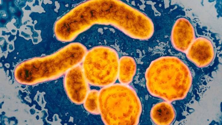 Qué es la hepatitis B y qué debes saber sobre la vacunación