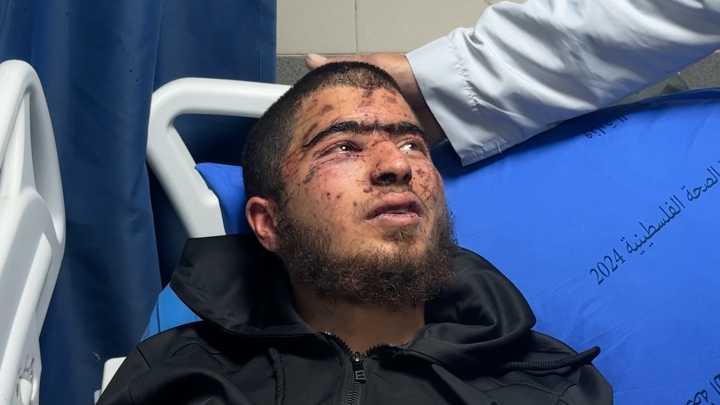 Video: Palestinian teen says he was tortured in settler kidnapping