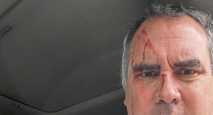 Candidato Rafael Belaunde sale vivo de milagro al ser atacado a balazos