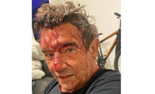 Recibió culatazos y un tiro: salvaje asalto a un vecino de City Bell y fuerte reclamo por seguridad