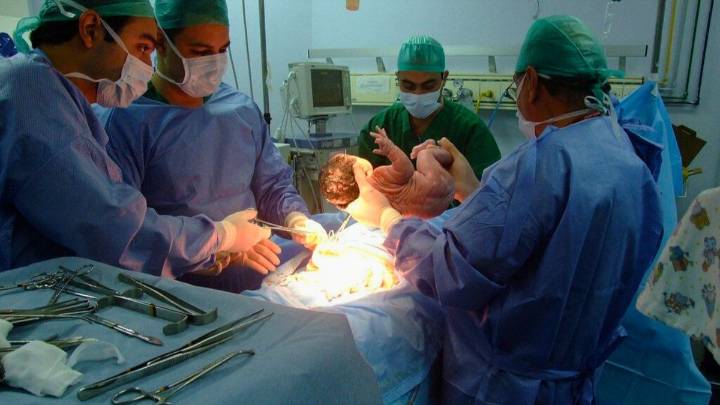 Médicos obstetras cuestionaron el plan oficial sobre parto por cesárea y reclamaron ser convocados