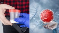 Donante de esperma con mutación cancerígena dejó casi 200 niños concebidos en Europa: familias afectadas fueron alertadas