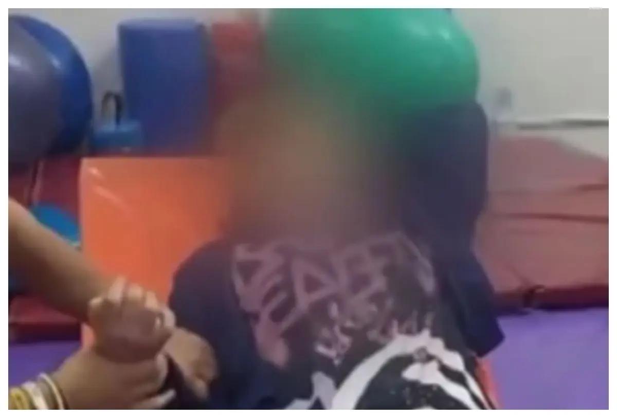 Joven sufre derrame cerebral tras rinoplastia por sus XV años en clínica de la CDMX