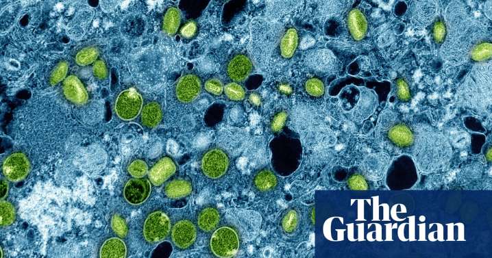 England health officials identify newly evolved variant of mpox