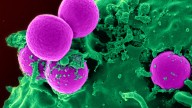 Grim Signals of Future Antimicrobial Resistance Found Lurking in Sewage