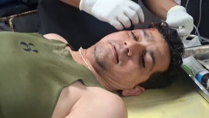 Sub Insp critical after attack by goons with sharp edged weapons, manhunt launched