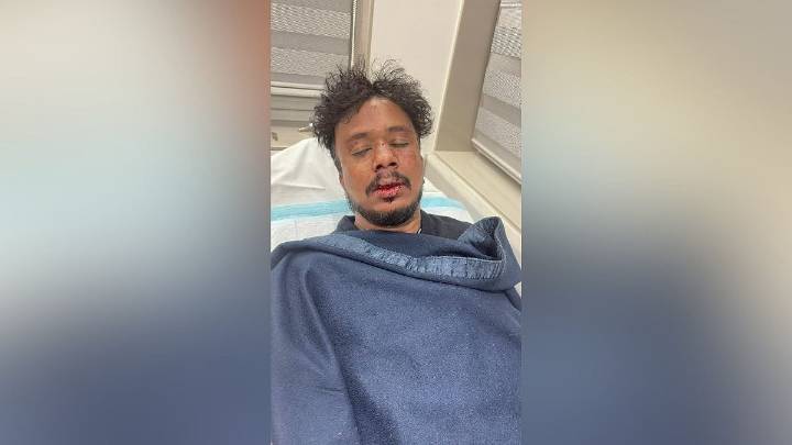 Mumbai: Social Activist Chetan Kamble Brutally Attacked In Dadar; Attempt To Silence Anti