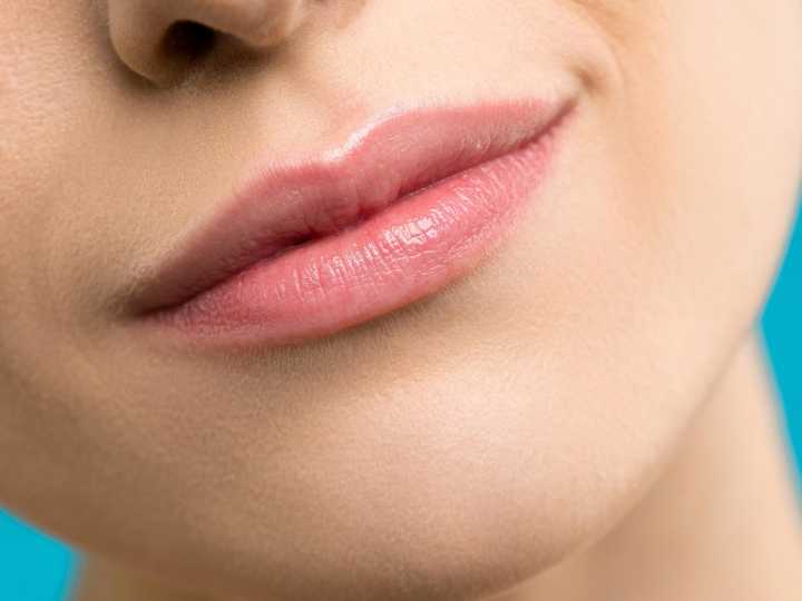 Se reventó un grano de la cara y tiempo después vivió una pesadilla: "No valió la pena"