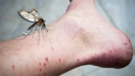 ¿Por qué los mosquitos me pican en los tobillos y cómo puedo evitarlo?