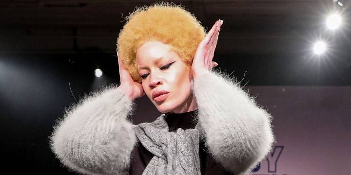 U.S. Albino Supermodel Diandra Forrest Fascinated the World with Her Unique Beauty