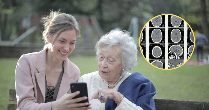 Científicos logran reducir el daño cerebral del Alzheimer al eliminar una proteína clave y observan mejoras en memoria