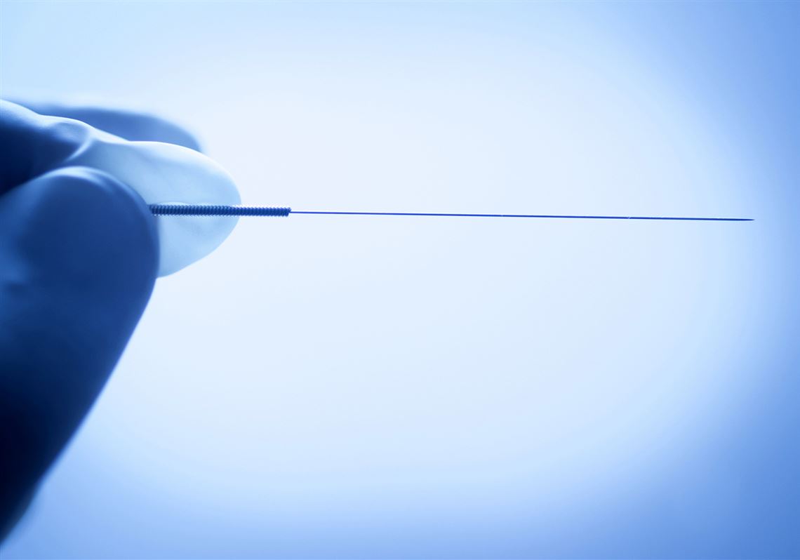 What is dry needling and what are its risks? What to know after Steeler T.J. Watt's lung partially collapsed