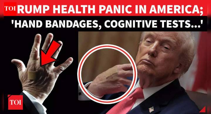 ‘TOO MANY HANDSHAKES!’: Karoline Leavitt’s Bizarre Explanation Of Trump’s Bandages & Cognitive Tests