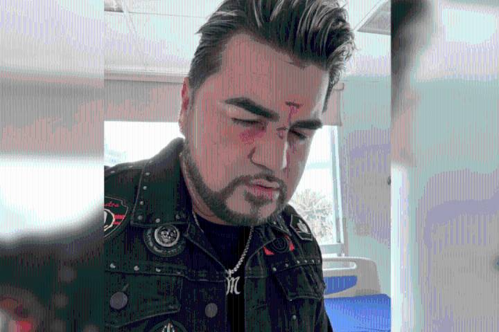 El Mimoso preocupa a fans tras difundir foto con heridas