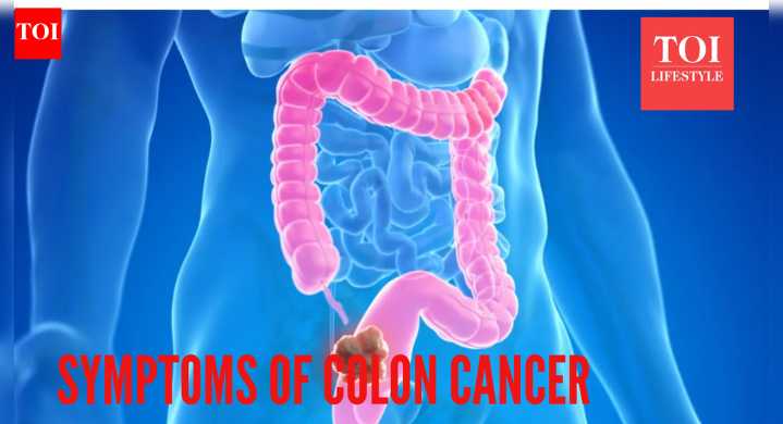 Colon Cancer Symptoms: Man gets diagnosed with Colon Cancer at 31 with these 6 symptoms; Gastroenterologist explains why you should never ignore them