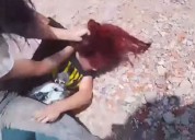 Ocurrió en Pablo Nogués. Violencia escolar: dos adolescentes se trenzaron a golpes y los familiares le tiraron agua hirviendo a los docentes