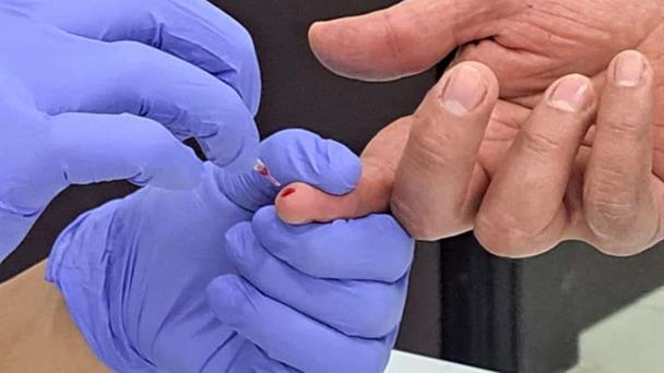 Detectan VIH en el CEDES