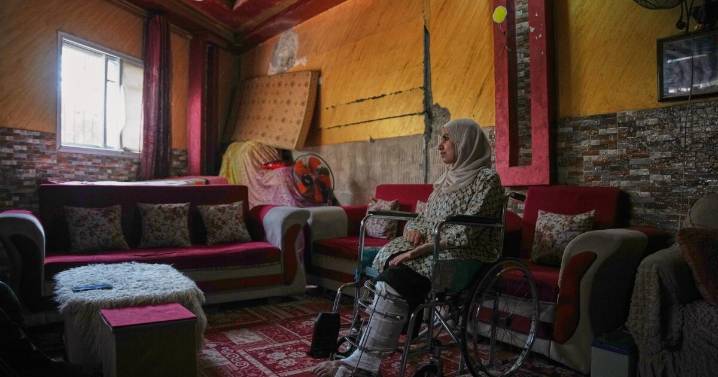 Amputados en Gaza luchan por reconstruir sus vidas ante la escasez de prótesis