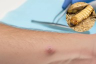 México registra 92 casos de infección por gusano barrenador en humanos