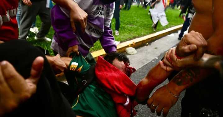 A dos años del protocolo Antipiquetes, denuncian más de 2.500 heridos