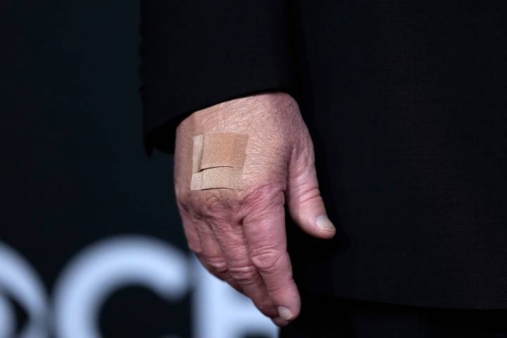 White House Speaks Out About Donald Trump’s Hand Bandages