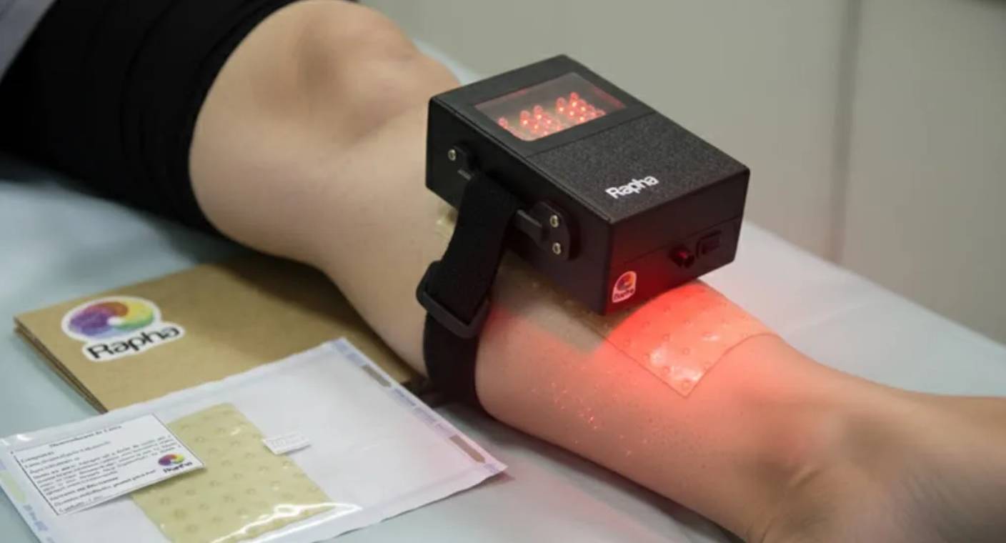 Investigadores de Brasil crean a ‘Rapha’, dispositivo que acelera cicatrización y promete evitar amputaciones