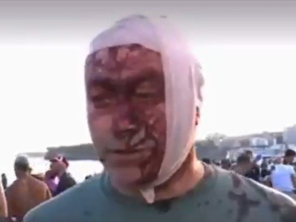 'Absolute massacre': Survivor describes Bondi Beach bloodbath