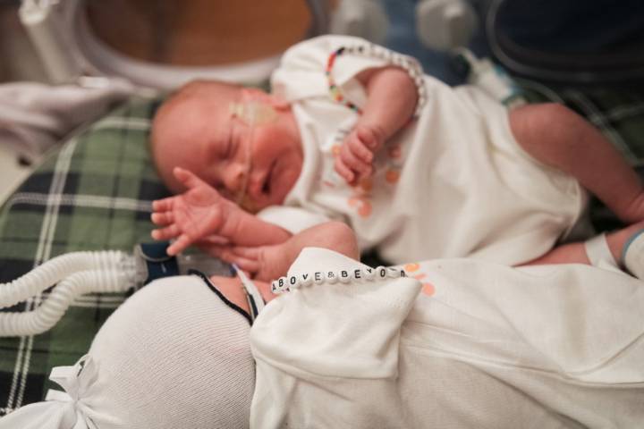 Dayton Children's and Kettering Health team up for NICU care