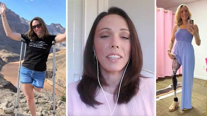 ‘Scariest day of my life’: An amputee’s physical & mental journey (Enable: The Disability Podcast)