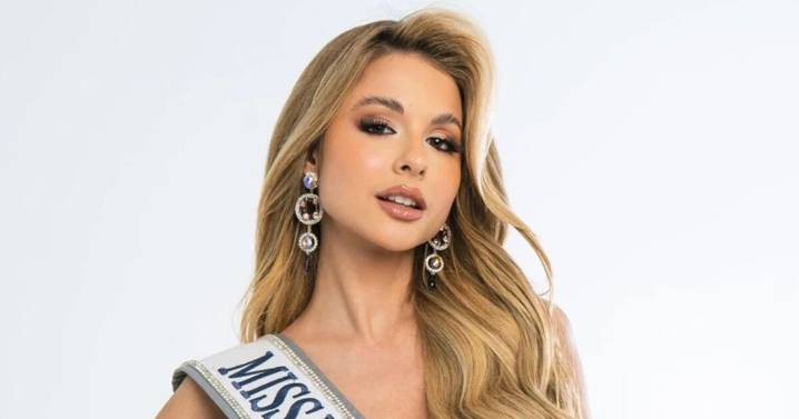 "Esta soy yo": Aldana Masset contó la historia detrás de la valiente decisión de hablar públicamente sobre su alopecia en Miss Universo