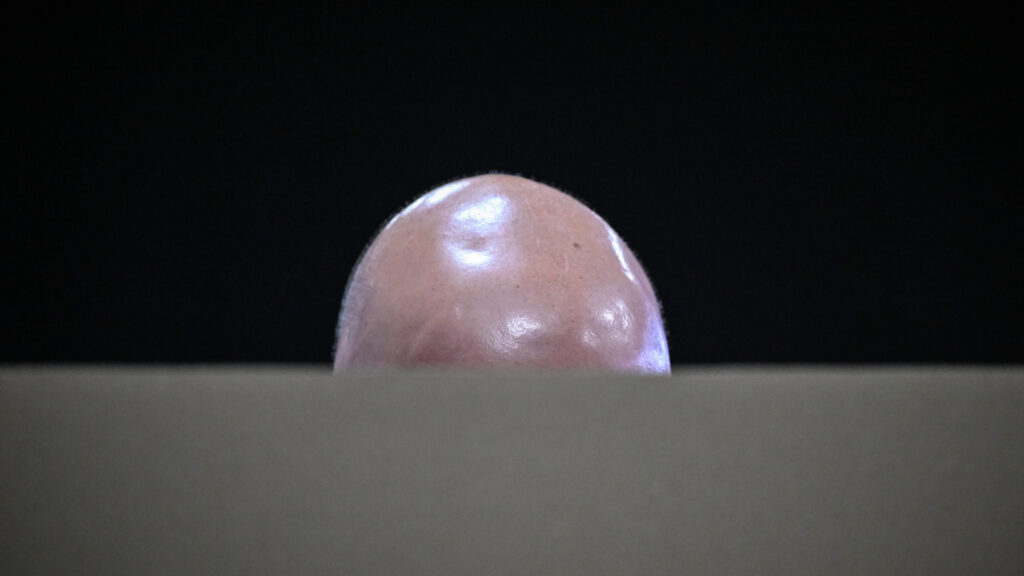 Hair loss drug by Cosmo Pharmaceuticals succeeds in Phase 3 trial