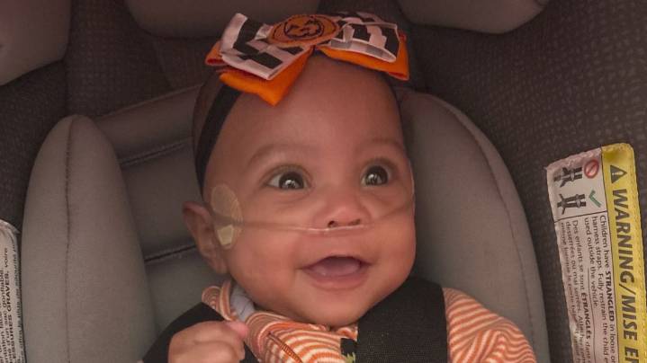 Cleveland baby born at 24 weeks, weighing just 12 ounces, defies the odds