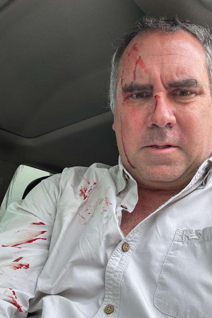 Candidato presidencial de Perú sobrevive a un atentado tras ser tiroteado en su vehículo