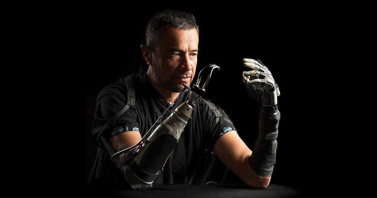 Improved Bionic Hand Has A Mind Of Its Own, Researchers Say