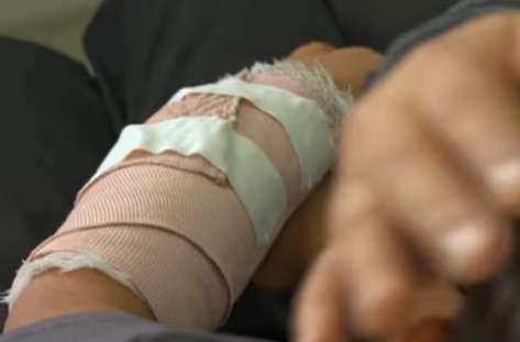 Niño de 13 años herido por pólvora en Pasto fue retirado de urgencias por sus padres